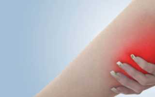 Симптомы и лечение растяжения икроножной мышцы