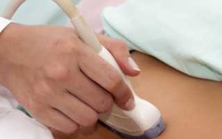 УЗИ органов малого таза: подготовка и расшифровка