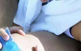 Как применять водочный компресс?