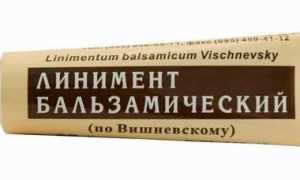 Мазь от гематом и синяков: какую лучше выбрать?