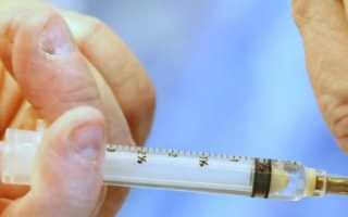 Как проявляется и лечится теносиновит сухожилий?