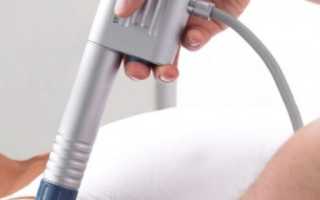 Как разспознать и лечить разрыв суставной губы?