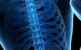 Болезнь Пертеса: причины, симптомы и лечение