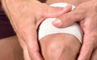 Что такое экзостозы и как их следует лечить?