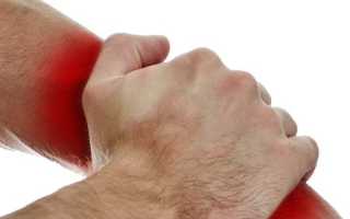 Что такое ушибы и как их лечить